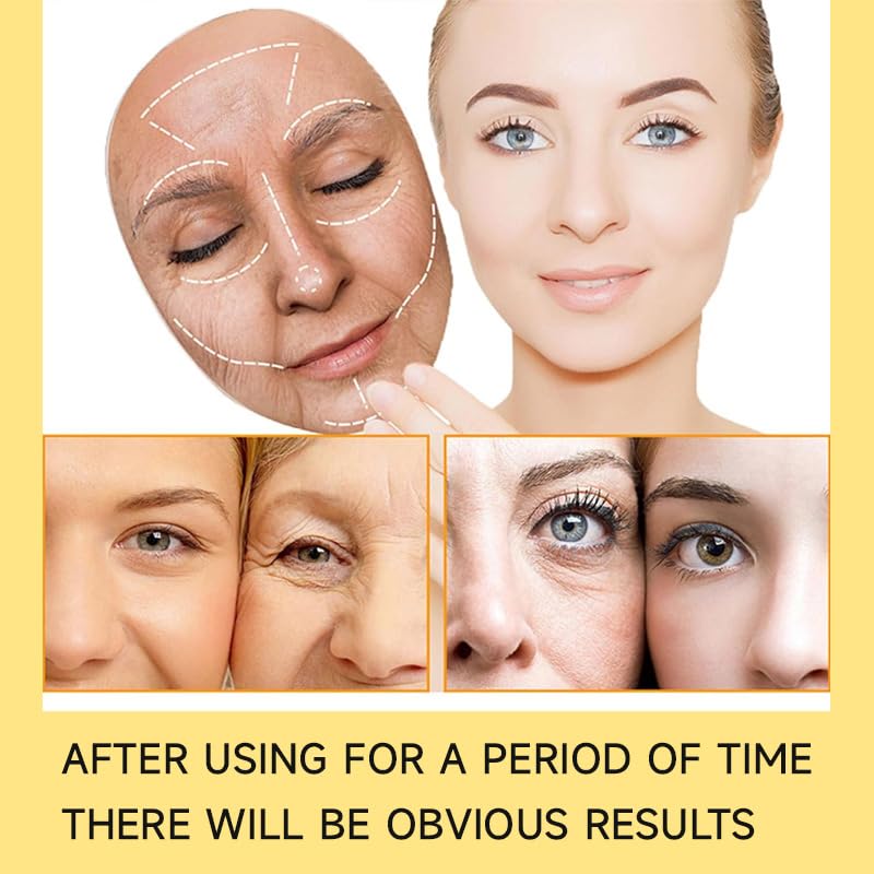 Pure Royal Gold Turmeric Cream – Brightening & Anti-Acne Facial Moisturizer