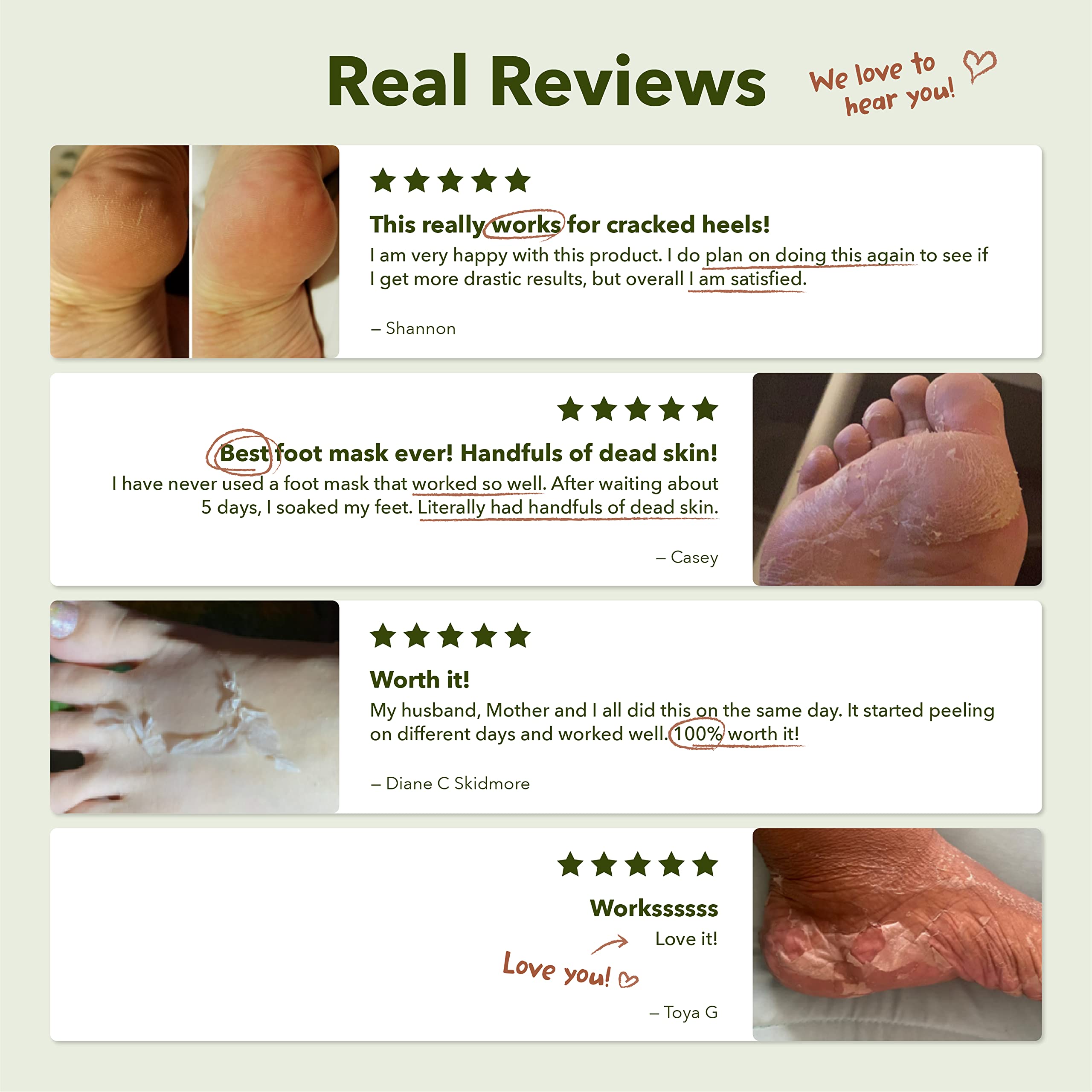 Purederm Shiny & Soft Foot Peeling Mask (6 Pack) – Exfoliating Peel for Smooth, Hydrated Feet