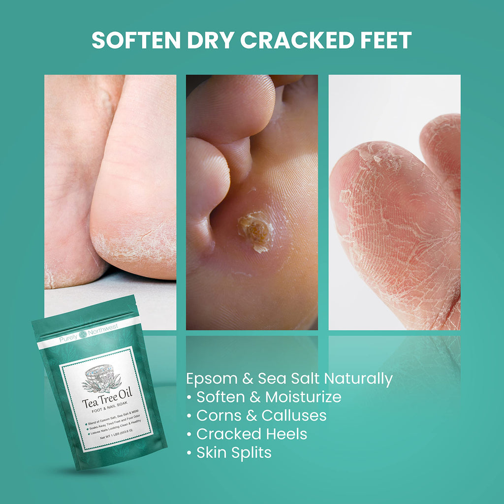 Purely Northwest 3 Lbs Tea Tree & Peppermint Foot Soak – MSM & Epsom Salt