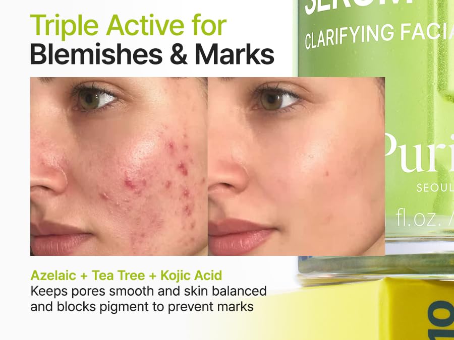 PURITO Azelaic Acid 10% + Kojic Acid + Tea Tree Serum – Acne & Marks (30mL)