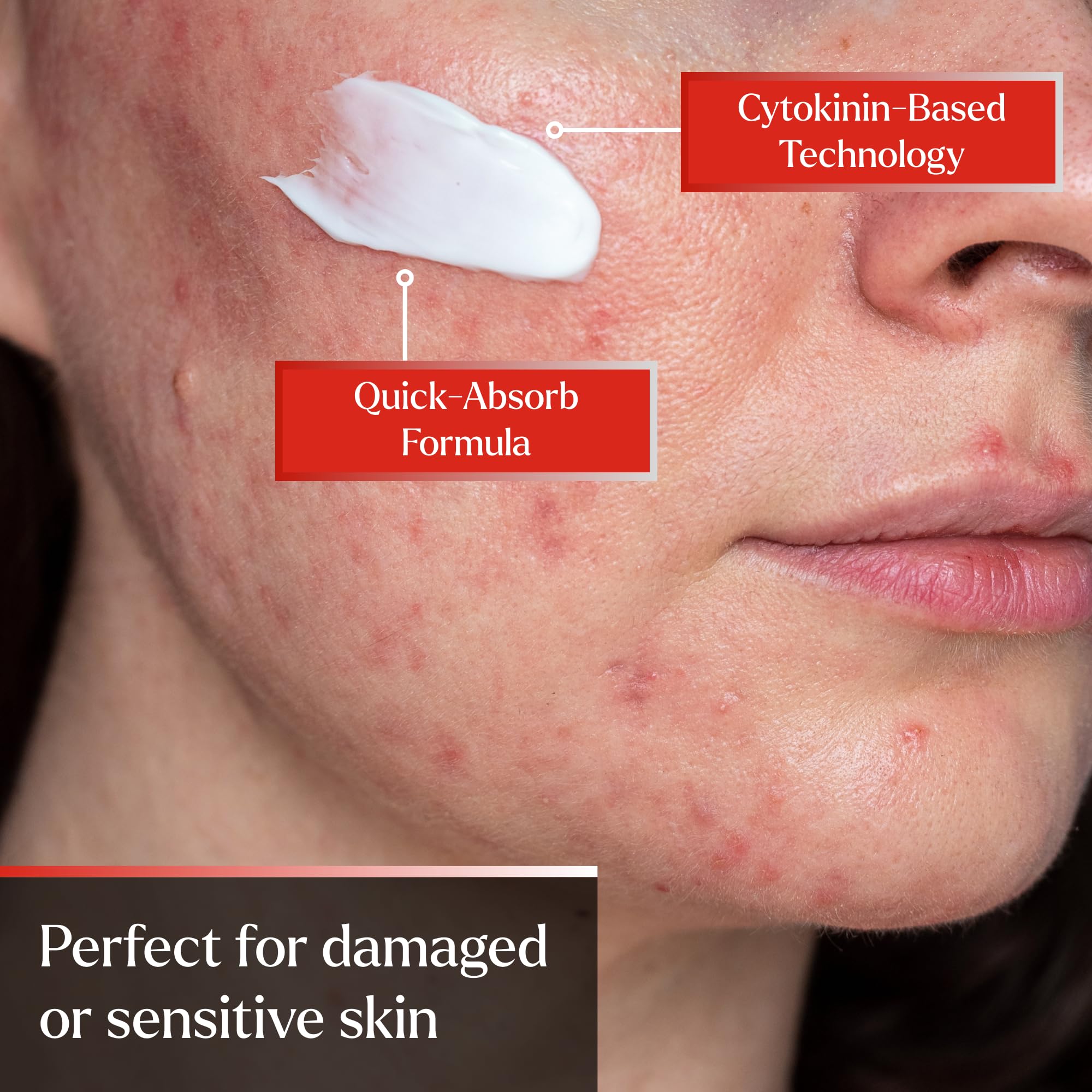 PyratineXR Creme – Antiaging & Rosacea Skin Treatment (2 oz)
