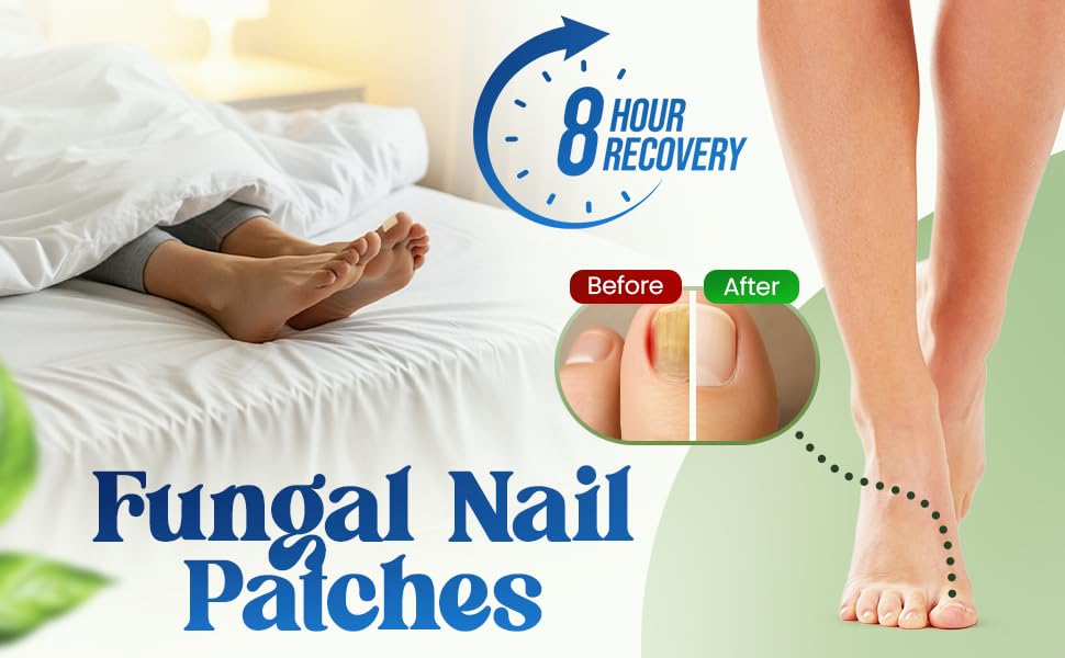 QUDSIYA Premium Fungal Nail Patches – Overnight Toe Nail Care (21 Count)
