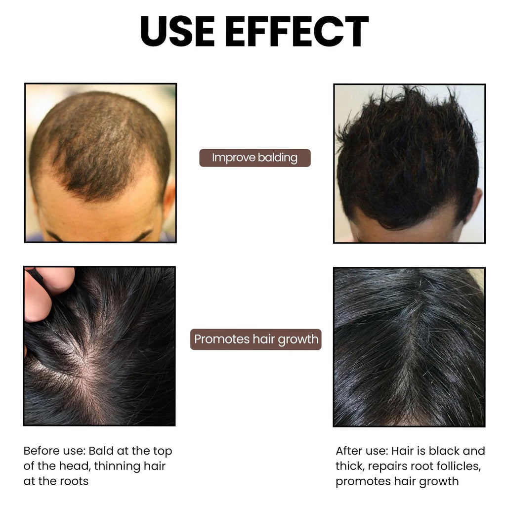 QUZOYU Thicair Hair Regrowth System – Volumizing Serum with Copper Peptides & Collagen