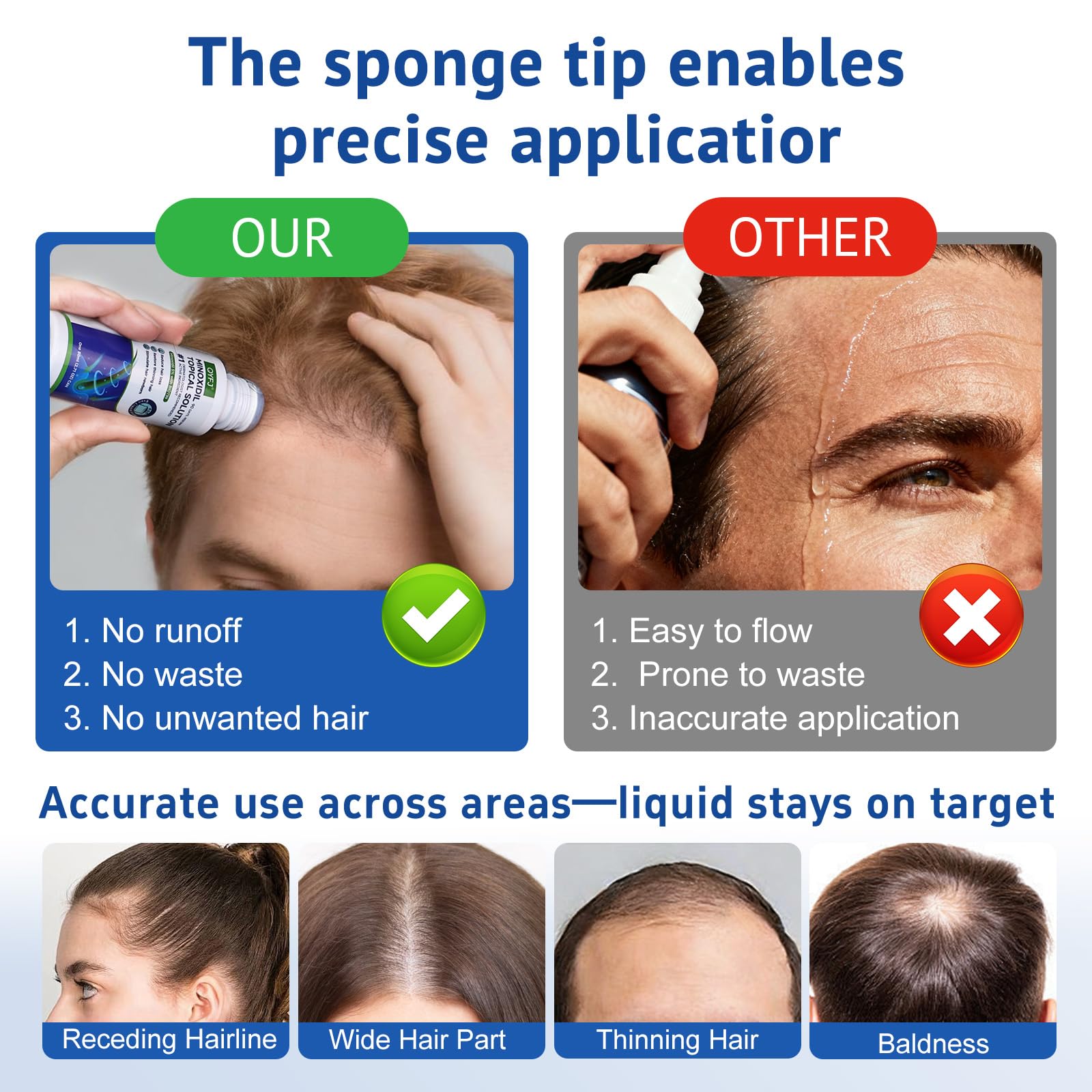 QYFJ 6 Pack 5% Minoxidil for Hair & Beard with Biotin — 8-Month Supply