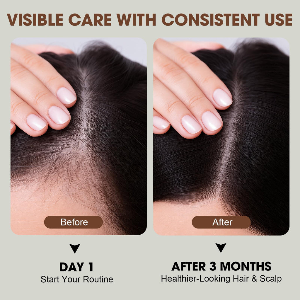 Racgrul PP405 Hair Treatment – Lightweight Scalp Serum for Fuller-Looking Hair