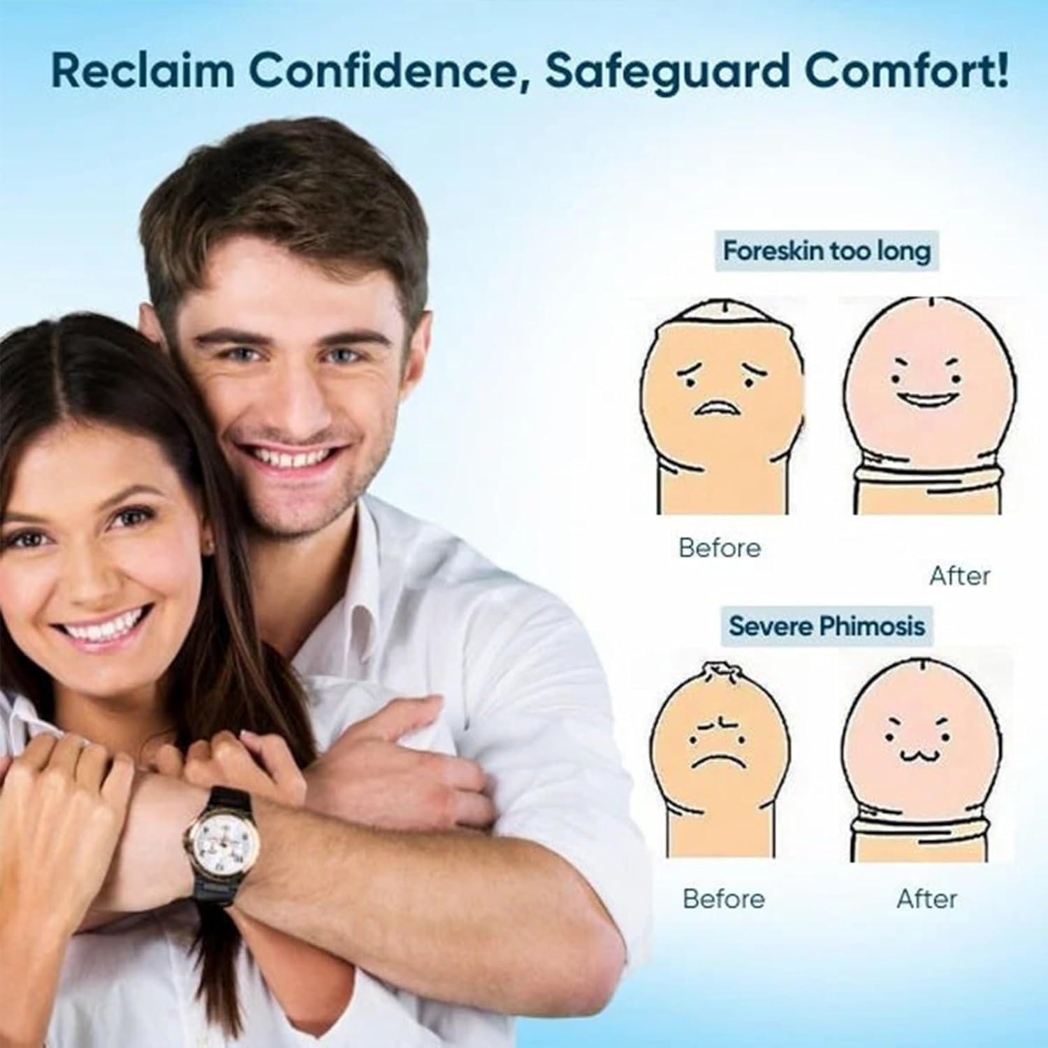RCSCBC Redundant Prepuce Corrector Gel – Professional Quick Effect (2PCS)