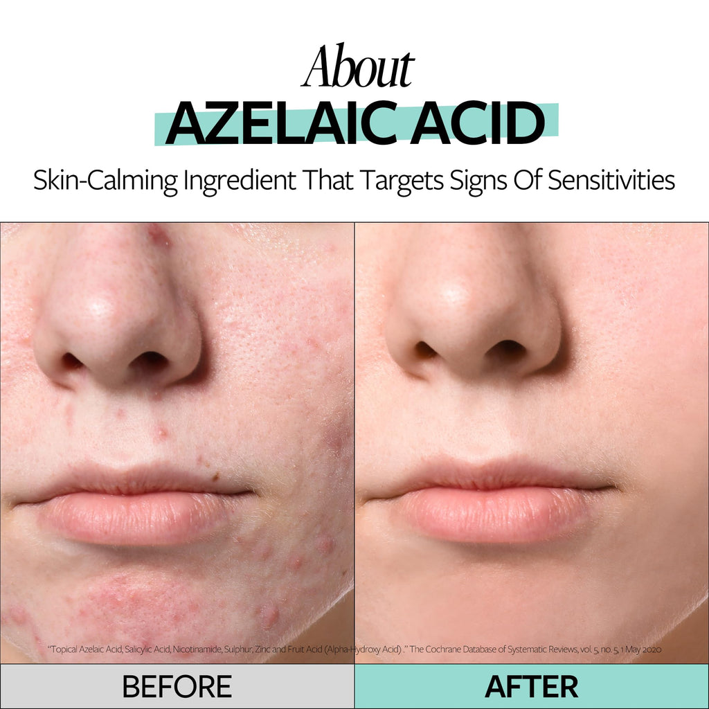 RE:CIPE Azelaic Acid 10% Soothing Ampoule – Calming Serum for Sensitive Skin | 1.01 fl oz
