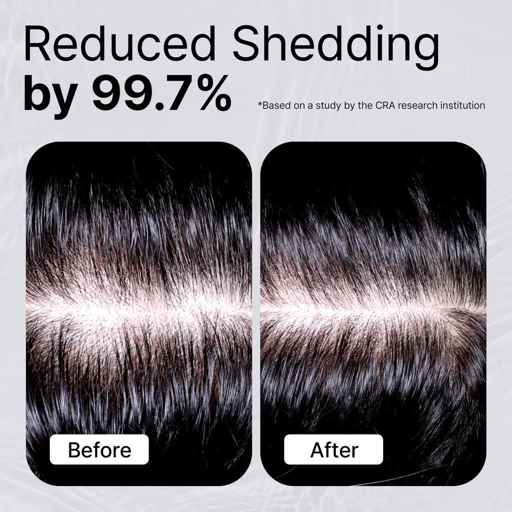 Refilled Booster Plus Moisture – Hair Growth Serum & Thickening Scalp Treatment with Built-In Massager