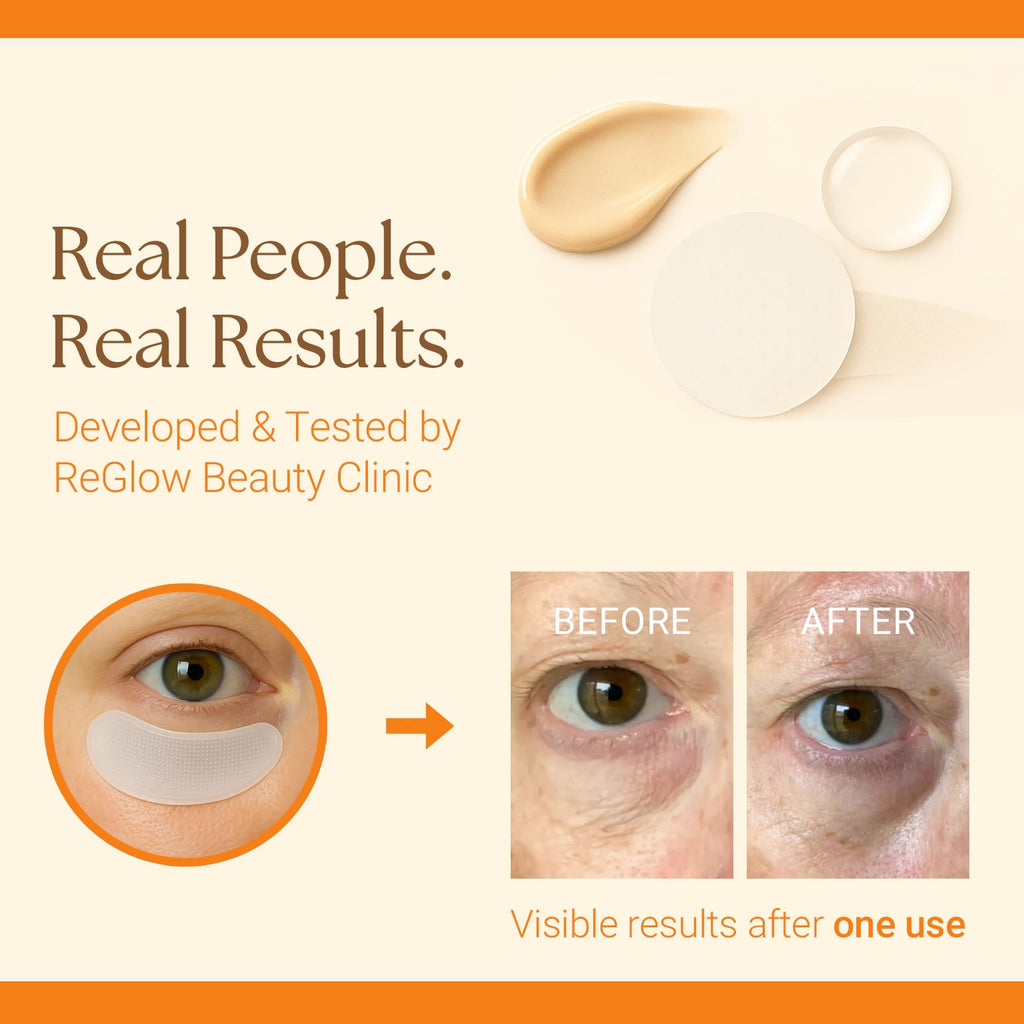 ReGlow Restore Microneedle Eye Patches – Overnight Smoothing with Hyaluronic Acid, Collagen & Peptides
