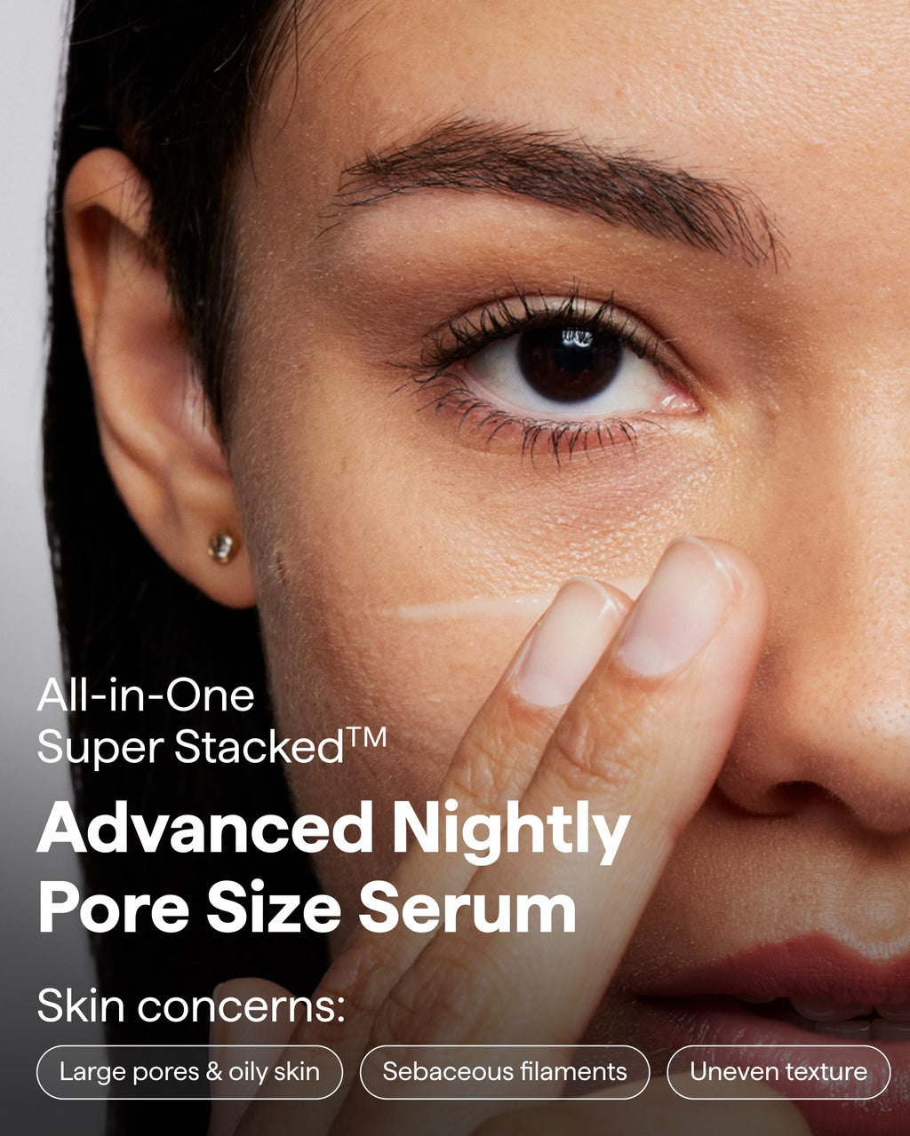 Remedy Science Remedy for Pore Size – Pore Refining Advanced Serum with Retinol, BHA, Niacinamide | Large Pore Minimizer