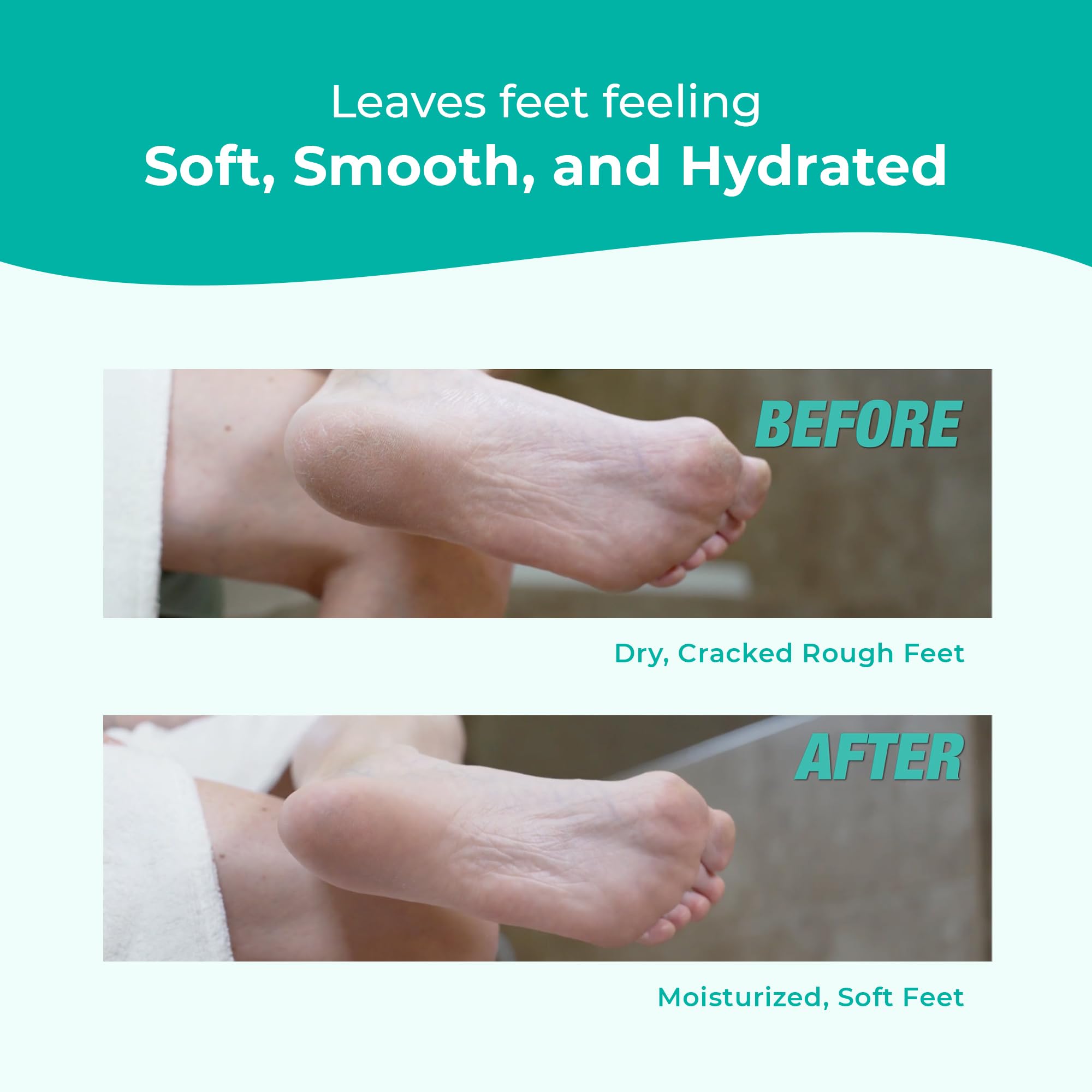Richenna EZ Foot Care Cream – Advanced Exfoliating Urea Foot Cream for Dry Cracked Heels | 14 Natural Ingredients | 100ml