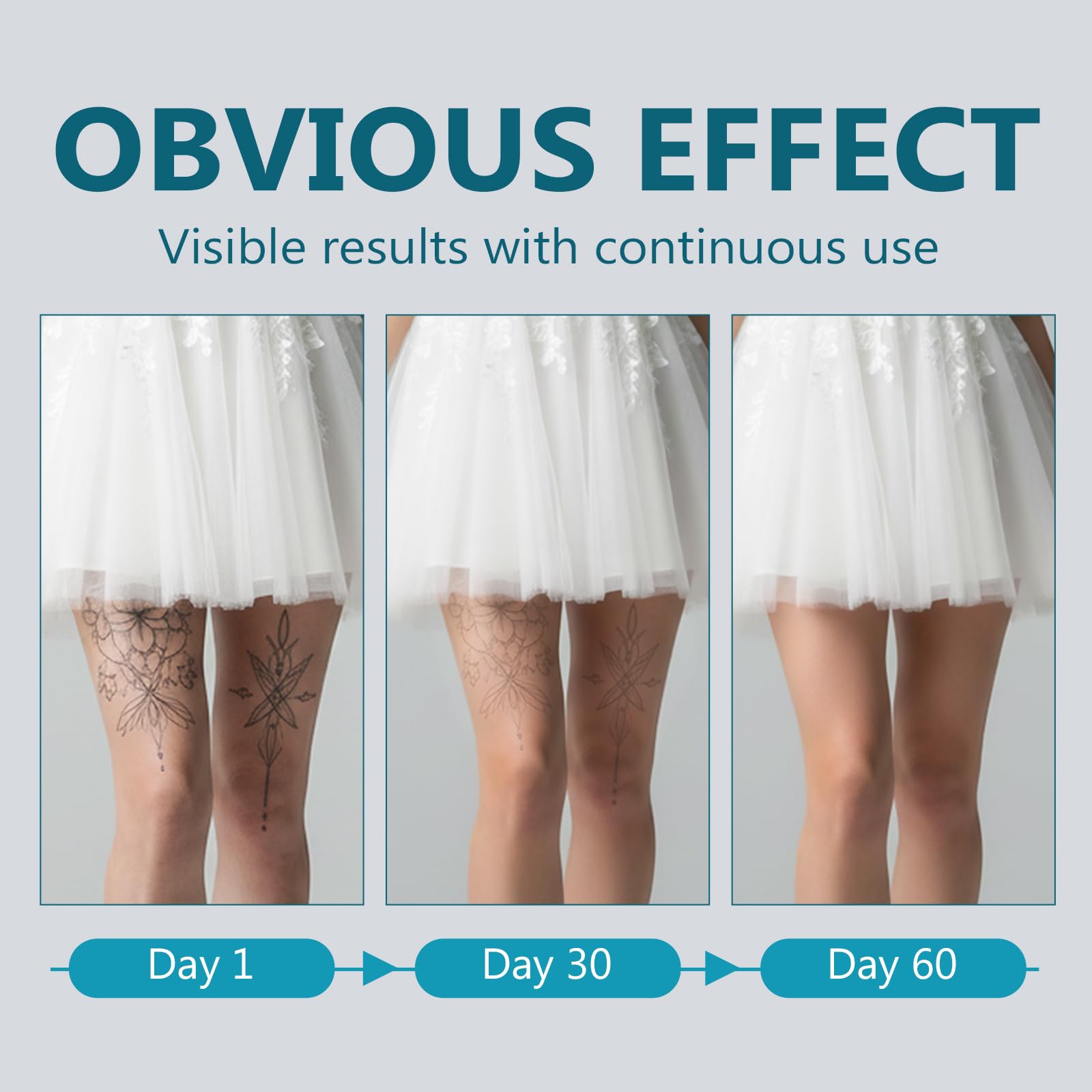 Richie House Tattoo Remover Spray – Natural, Non-Invasive Ink Fading
