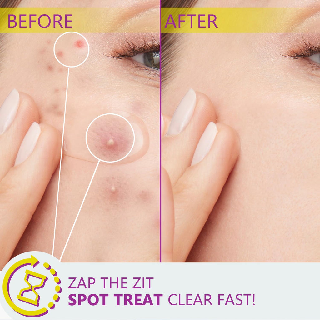RIGBOO Azelaic Acid 12% Serum – Niacinamide & Hyaluronic Acid