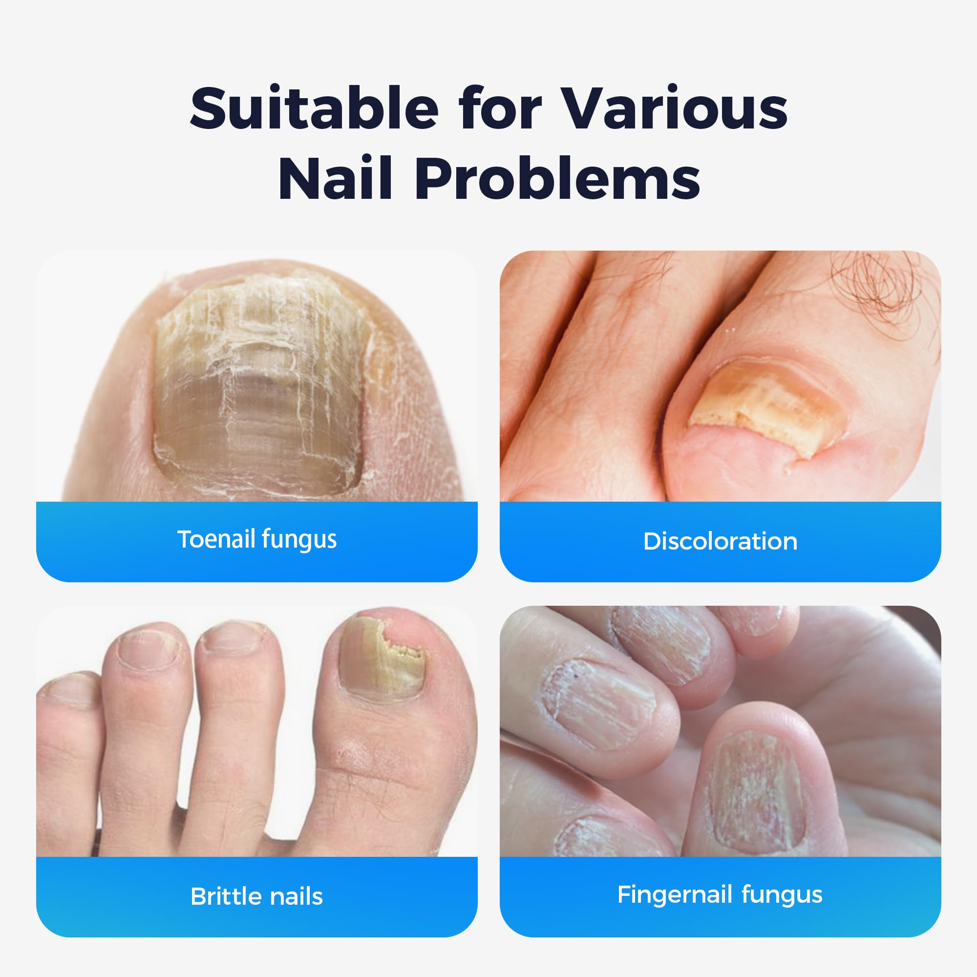 Rinlus Fungal Nail Patches & Nail Repair Pen – Fast-Acting 7-Day Toenail Treatment