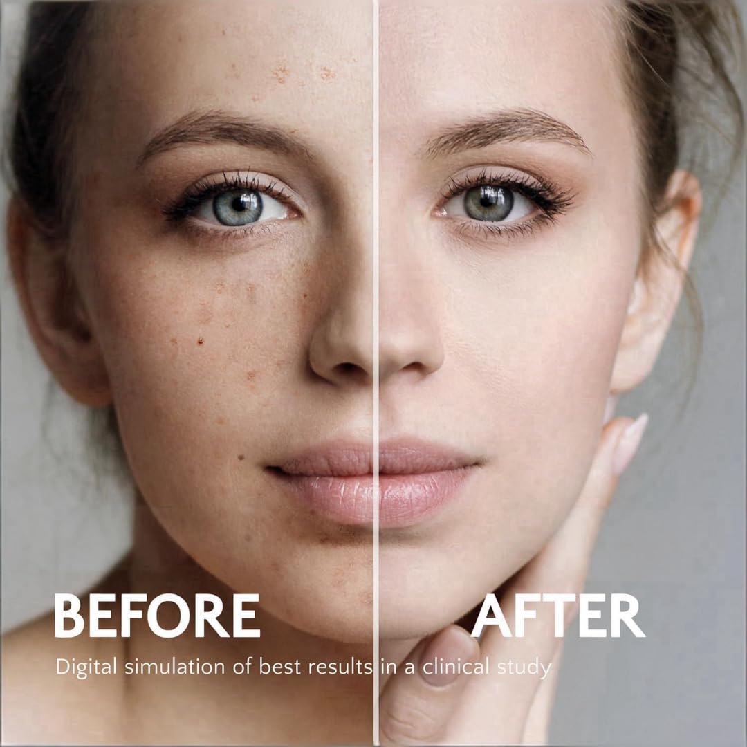 Rivocoda Hydraquinonol Dark Spot Brightening Cream – 4% Gentle, Hydrating, All Skin Types