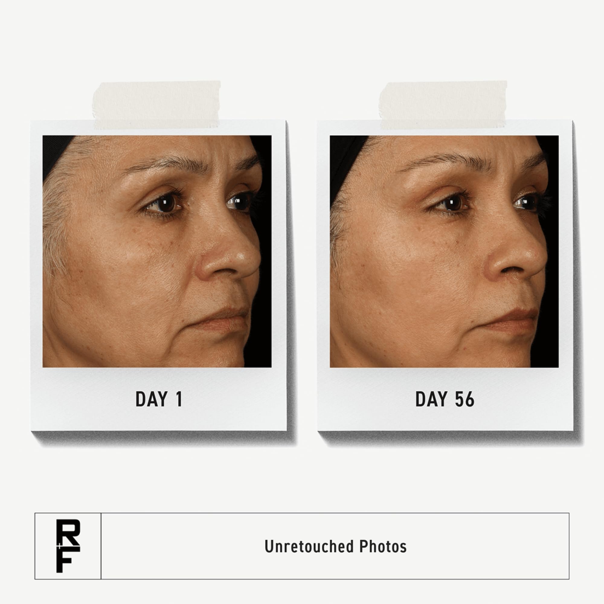 RODAN + FIELDS Total RF Serum 30 mL | Hydration & Fine Line Targeting for Women