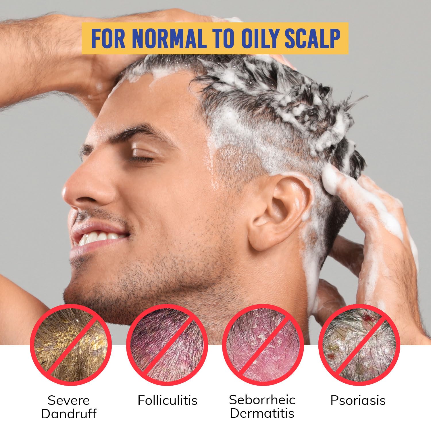 RootStim Seborrheic Dermatitis Shampoo | Dandruff & Itchy Scalp Relief with Selenium Sulfide