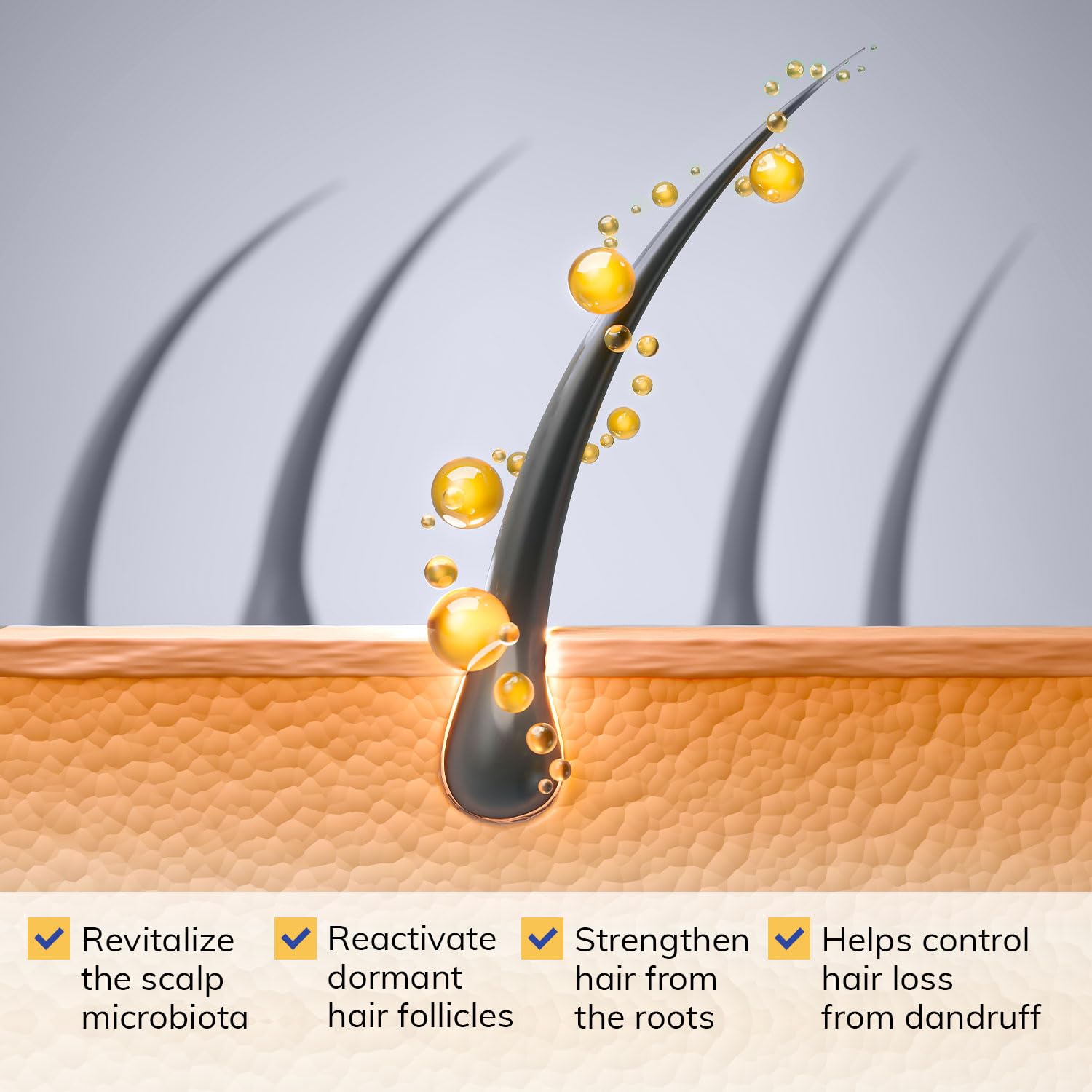 RootStim Seborrheic Dermatitis Shampoo | Dandruff & Itchy Scalp Relief with Selenium Sulfide