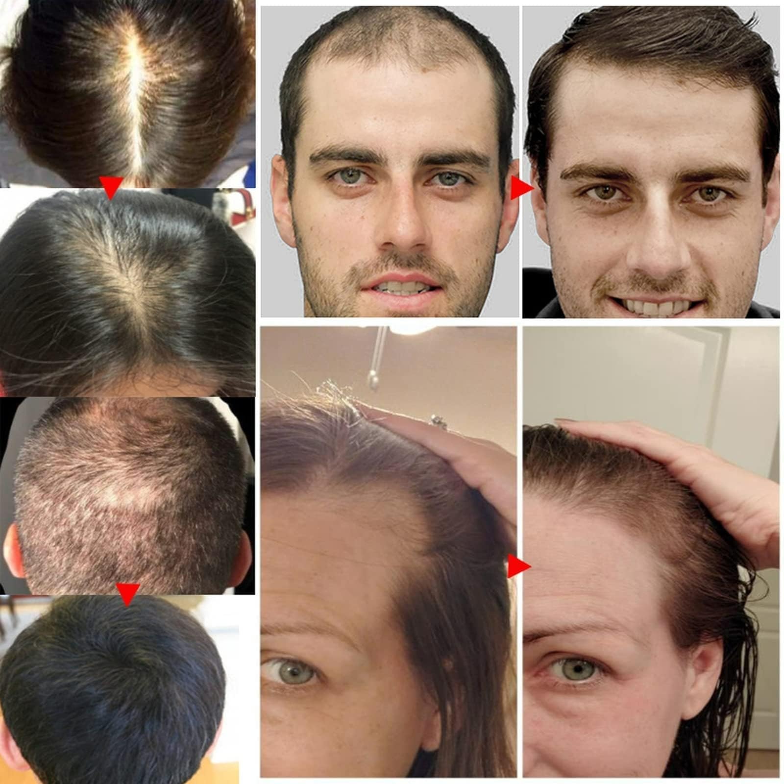Rosemary Oil for Hair Growth & Treatment – 60 ml / 2.2 fl oz Dropper Bottle Pack (2 Units)