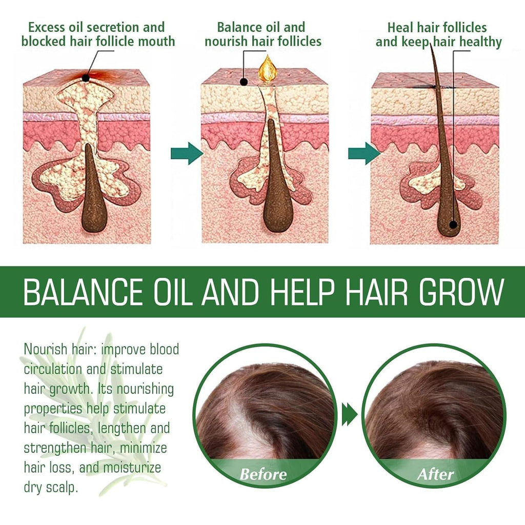 Rosemary Oil for Hair Growth & Treatment – 60 ml / 2.2 fl oz Dropper Bottle Pack (2 Units)