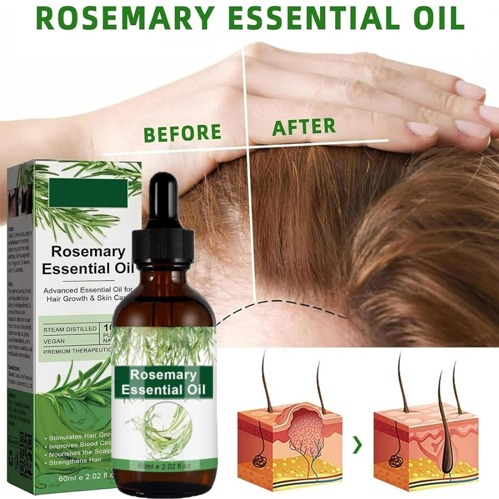 Rosemary Oil for Hair Growth & Treatment – 60 ml / 2.2 fl oz Dropper Bottle Pack (2 Units)