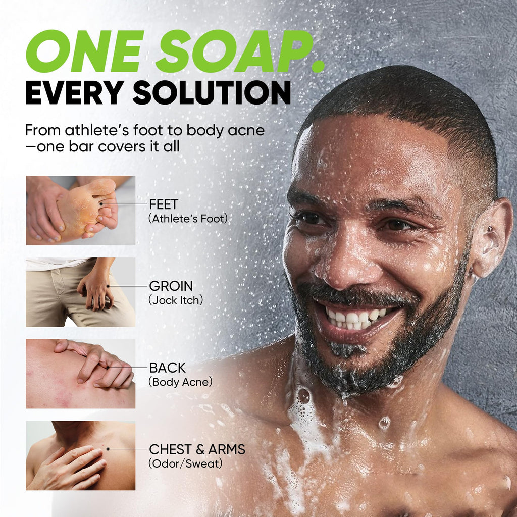 Roycederm Antifungal Soap for Active Skin – Medicated Bar with Tea Tree, Charcoal & Volcanic Ash