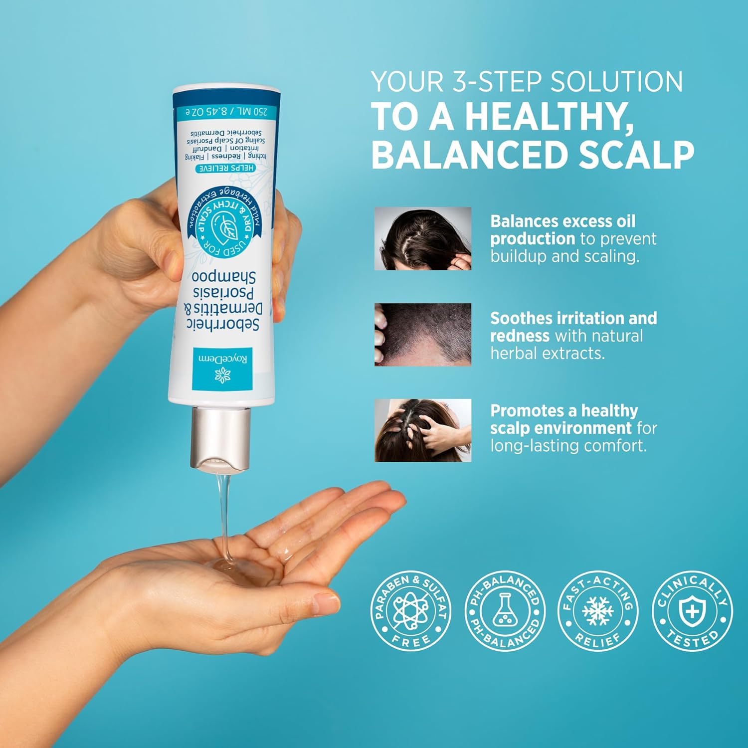 Roycederm Seborrheic Dermatitis & Psoriasis Scalp Treatment Kit – Shampoo and Cream for Dry Itchy Scalp