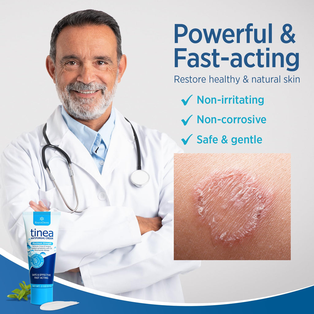 Roycederm Tinea Versicolor & Fungal Skin Cream — Multi-Functional Treatment (Pack of 2)