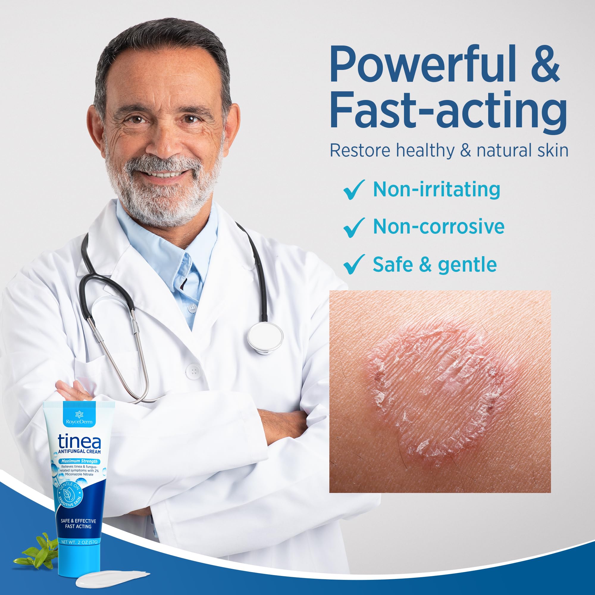 Roycederm Tinea Versicolor & Fungal Skin Cream — Multi-Functional Treatment (Pack of 2)