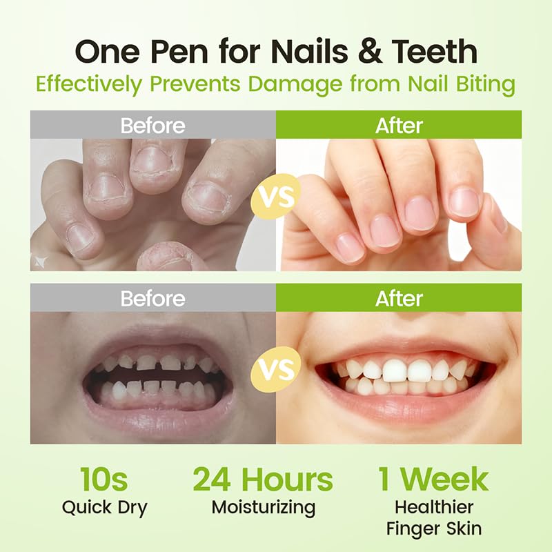 RUNBEN Stop Biting Nails for Kids – Bitter Taste Nail Care Pen, Safe & Non-Toxic for Age 0+ (0.14 oz)