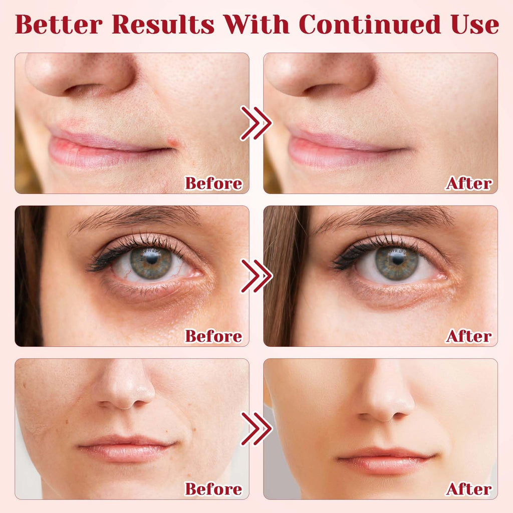 RunBuxd Dragons Blood Easy Cream – Retinol Face Cream for Firming & Nourishing (2 Pcs)