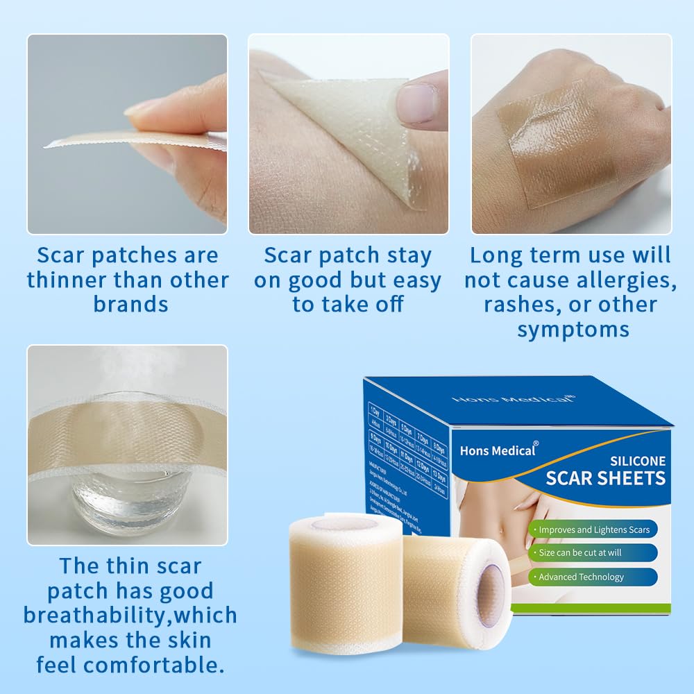 Safirst Medical Grade Silicone Scar Sheets – 1.6 x 157 in Roll for Keloid, C-Section & Burn Scars