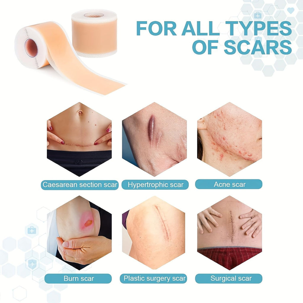 Safirst Medical Grade Silicone Scar Sheets – 1.6 x 157 in Roll for Keloid, C-Section & Burn Scars