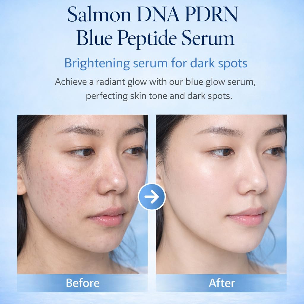 Salmon DNA PPRN Serum – 5000ppm PDRN, 6 Hyaluronic Acids, Niacinamide & Glutathione, Korean Anti-Aging