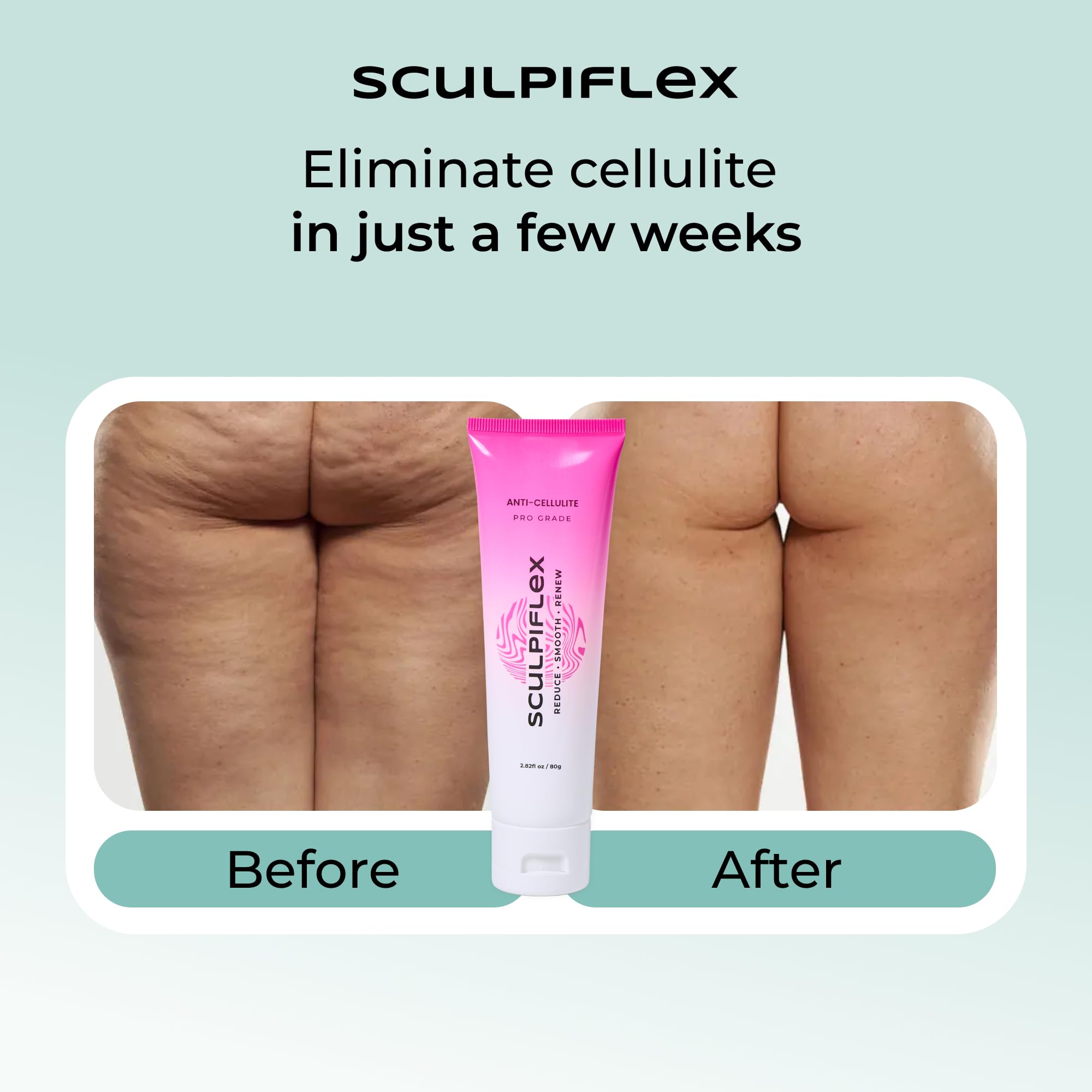 SCULPIFLEX Anti Cellulite Cream – Lifting & Firming Body Cream for Arms, Stomach & Legs