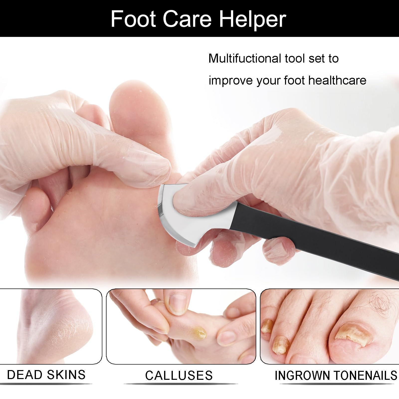 Segbeauty 7pcs Ingrown Toenail Removal Kit – Professional Pedicure Tools for Feet