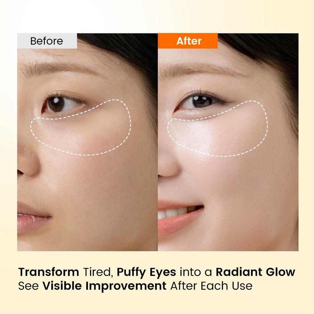 SEONGLOW Caffeine Under Eye Patches – 30 Pairs | Brighten & Hydrate