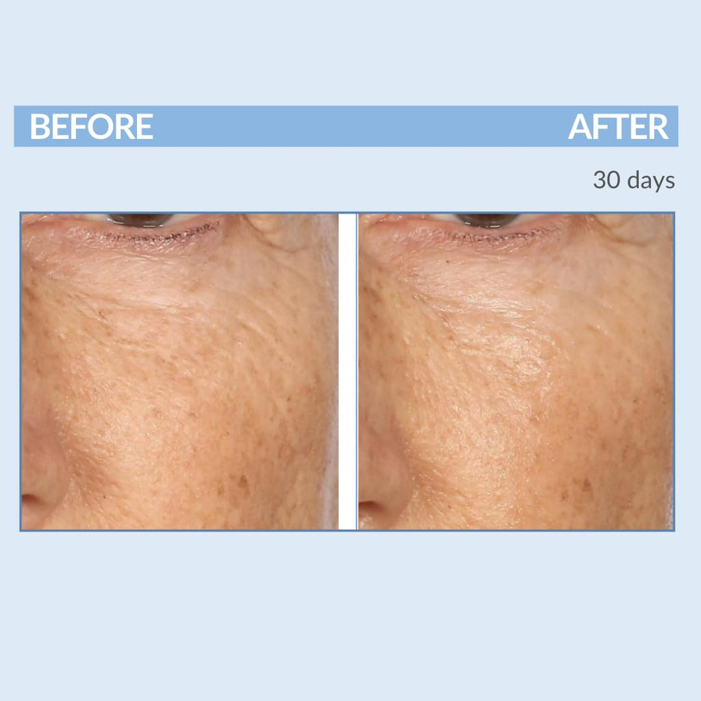 Serious Skincare Retinol Anti-Aging Set: Serum, Moisturizer & Cleanser (3-Piece Kit)