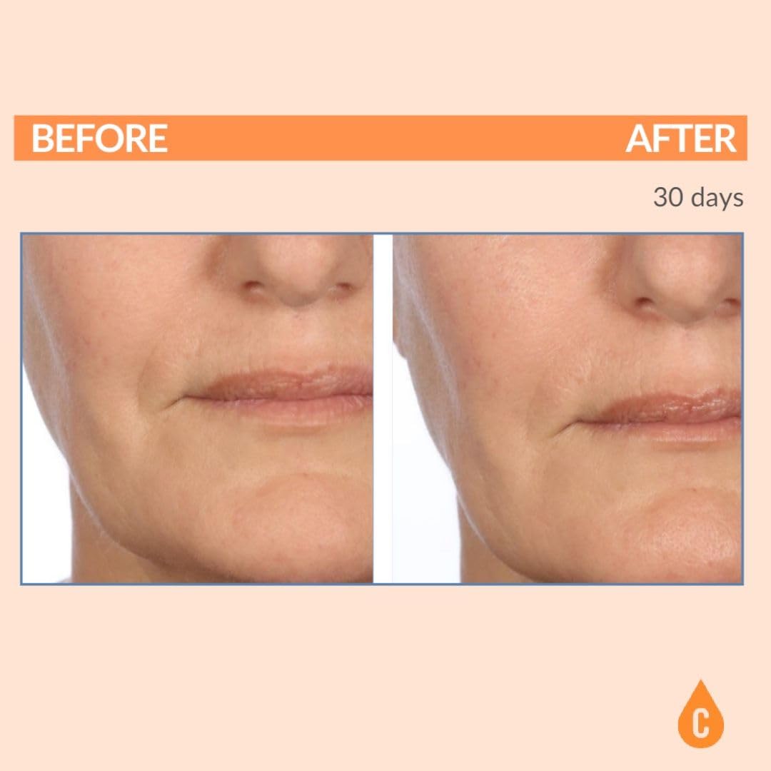 Serious Skincare Vitamin C SPF 30 Broad Spectrum Sunscreen Moisturizer for Face — Hydration, No White Cast