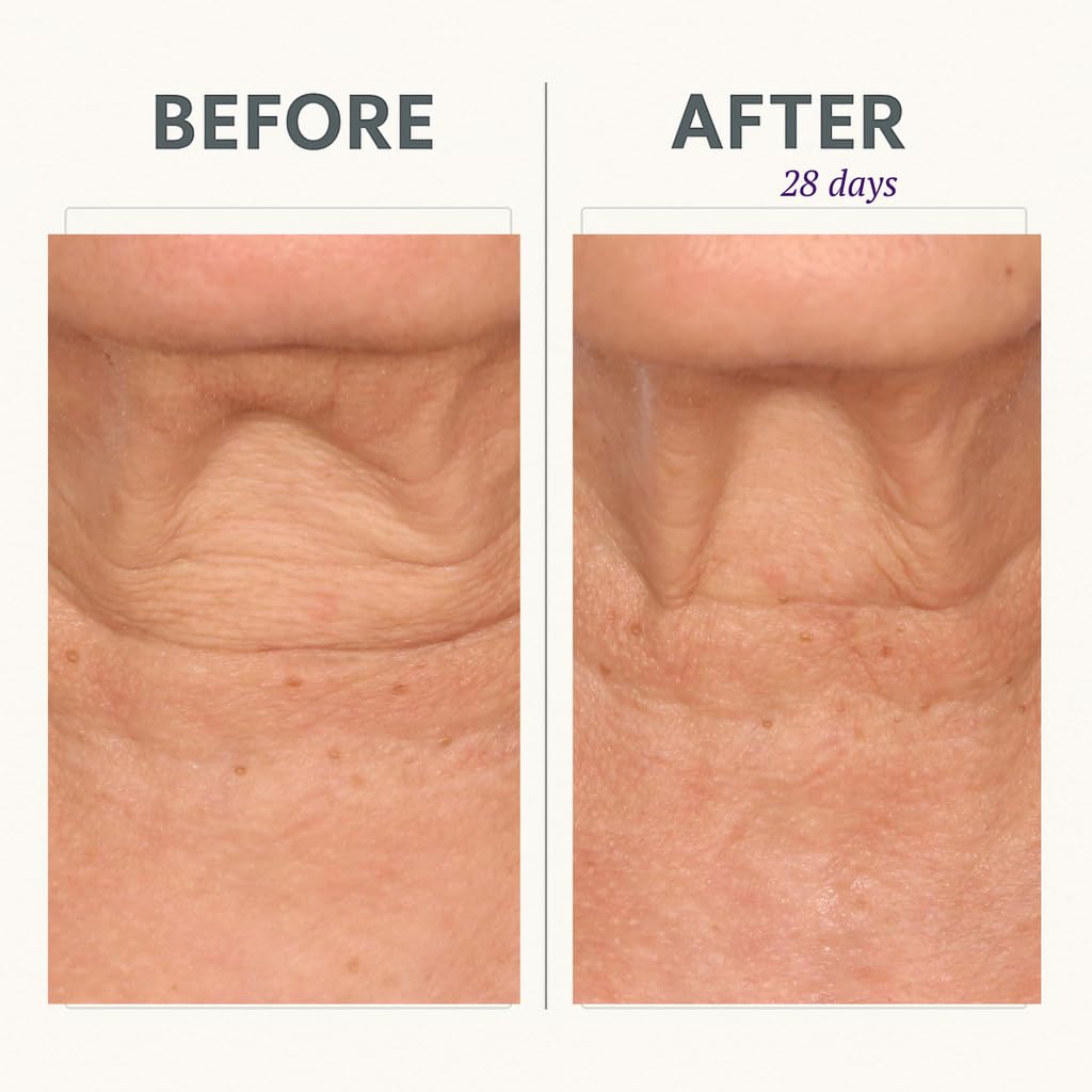 Serious Skincare Reverse Lift CORREC-CHIN IN-TENSE Firming Cream – Neck & Jawline