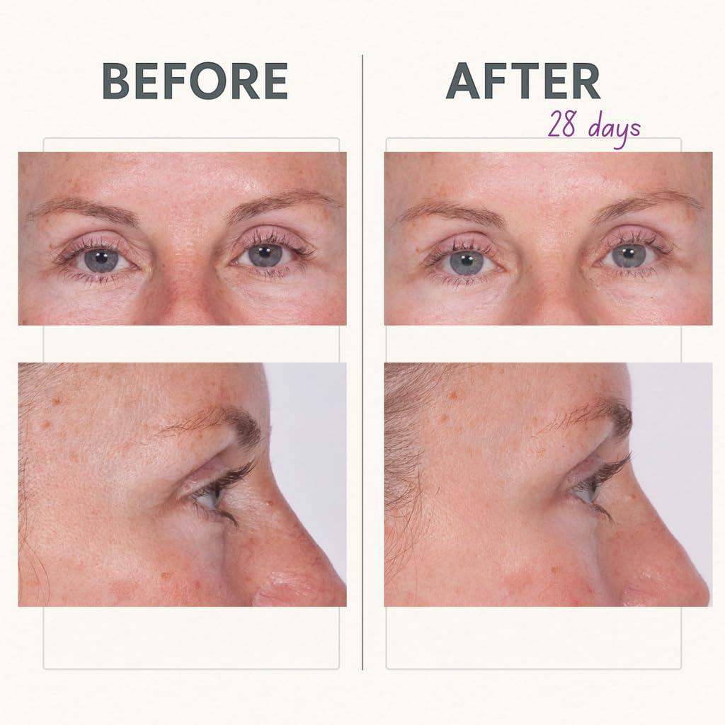 Serious Skincare Reverse Lift Eye Cream with Peptides – Hydration & Firming
