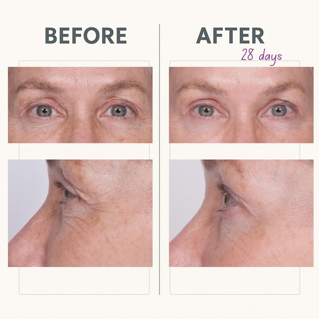 Serious Skincare Reverse Lift Eye Cream with Peptides – Hydration & Firming