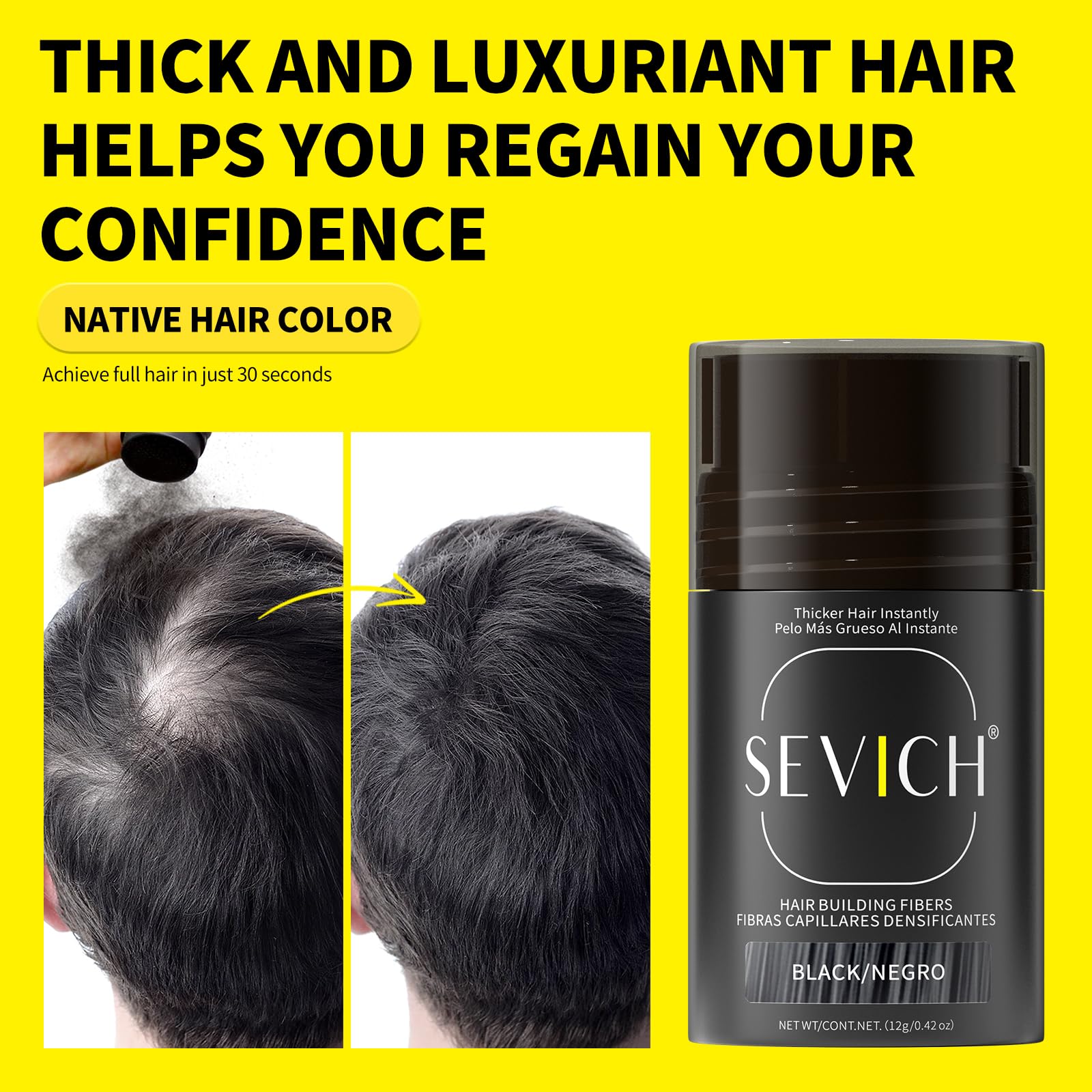 SEVICH Hair Fibers for Thinning Hair – Instant Thickening & Natural Look (12g Dark Brown)