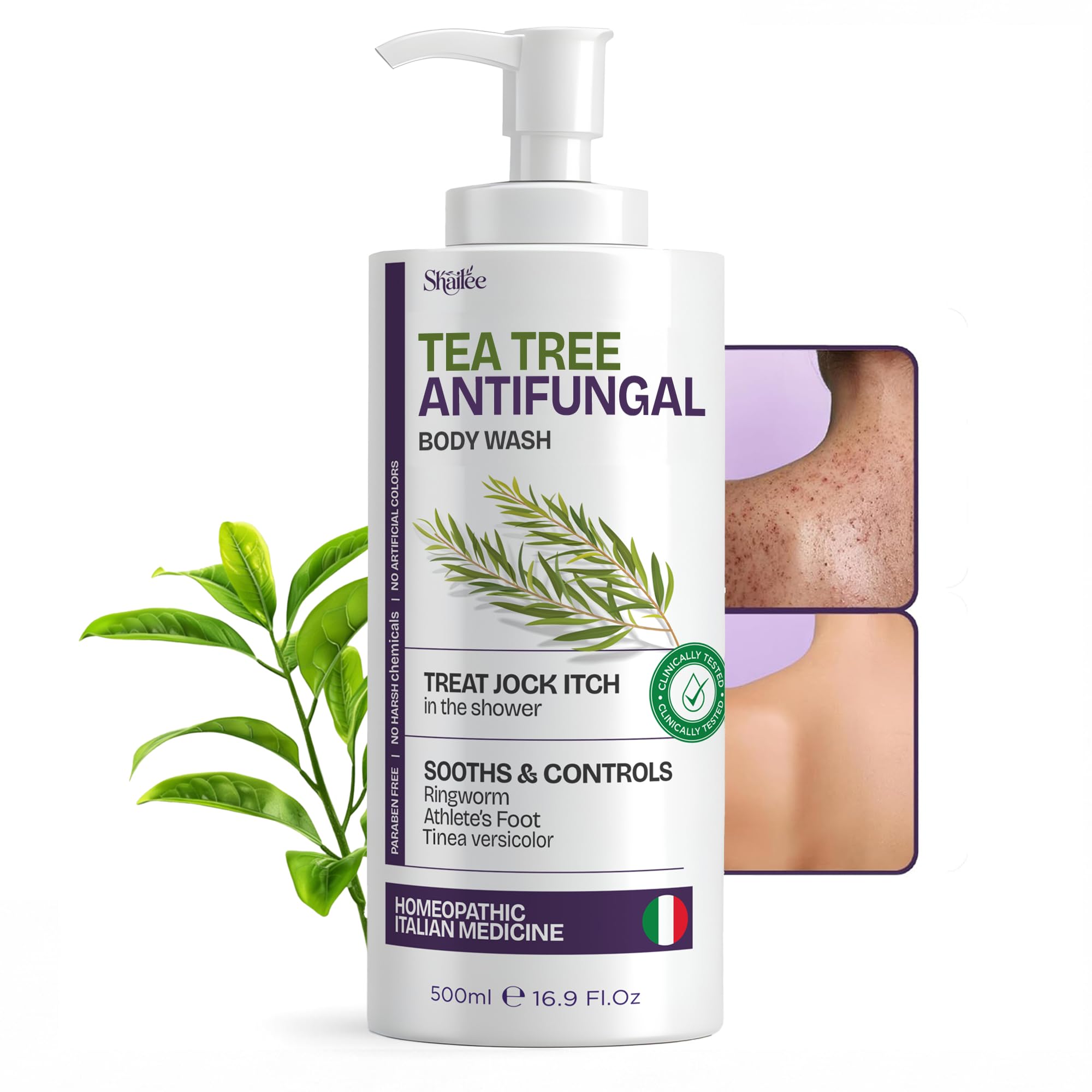 Shailee Antifungal Tea Tree Body Wash – 16.9 oz for Eczema & Body Acne