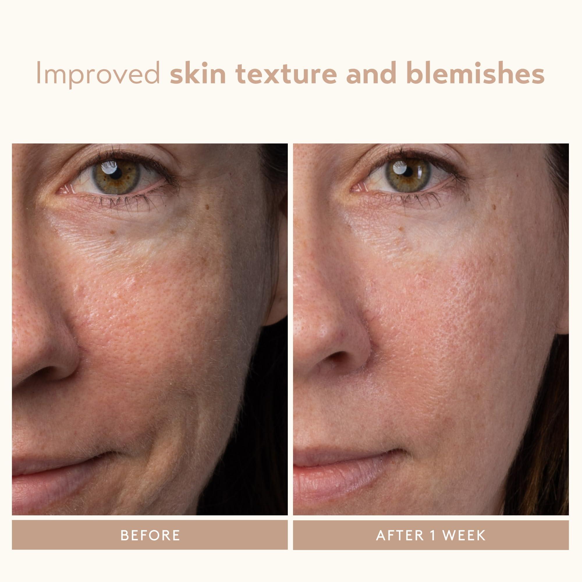 SHANI DARDEN Lactic Acid Serum | Travel Size Night Exfoliator for Radiant, Smooth Skin