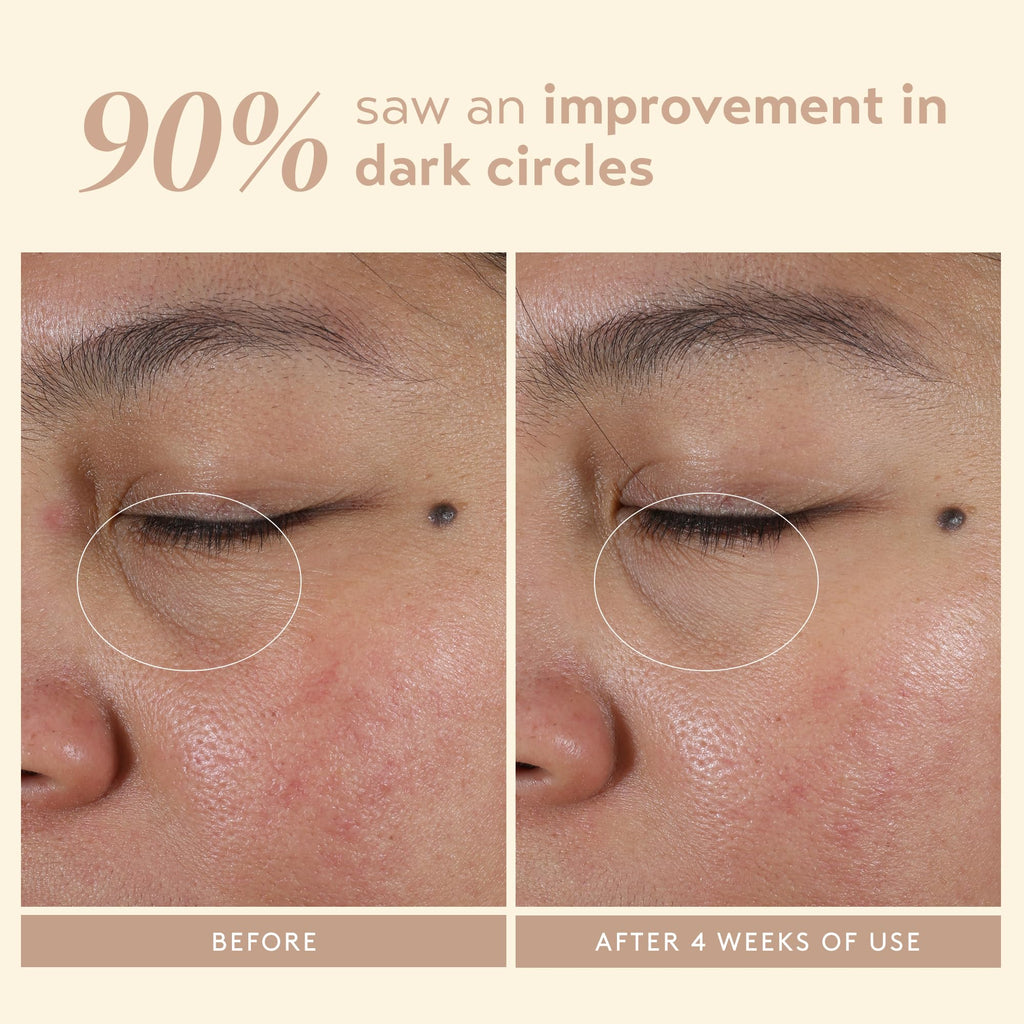 SHANI DARDEN Intensive Eye Renewal Cream | Hydrating Under-Eye Cream for Dark Circles & Fine Lines