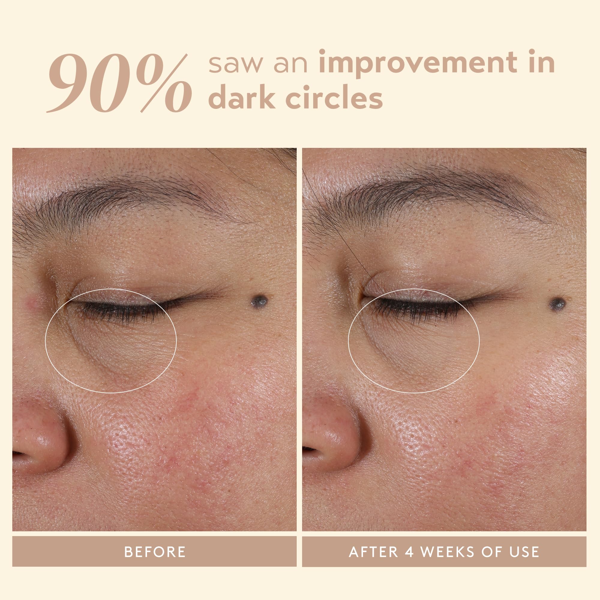 SHANI DARDEN Intensive Eye Renewal Cream | Hydrating Under-Eye Cream for Dark Circles & Fine Lines