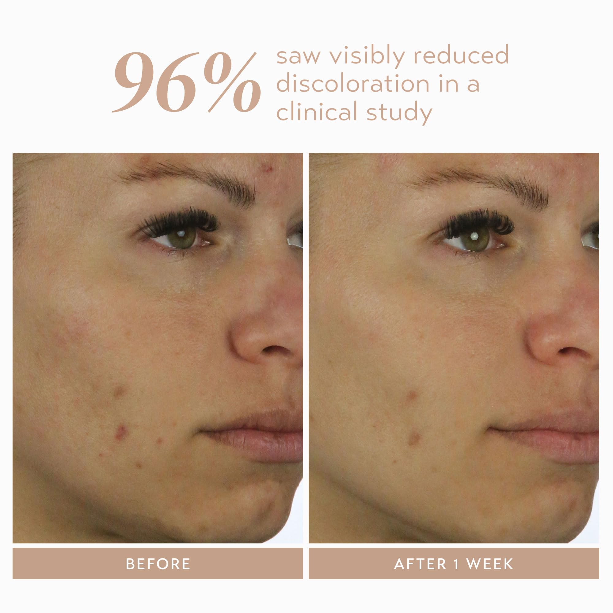 Shani Darden Rescue Serum with 10% Azelaic Complex | Lightweight Hydration