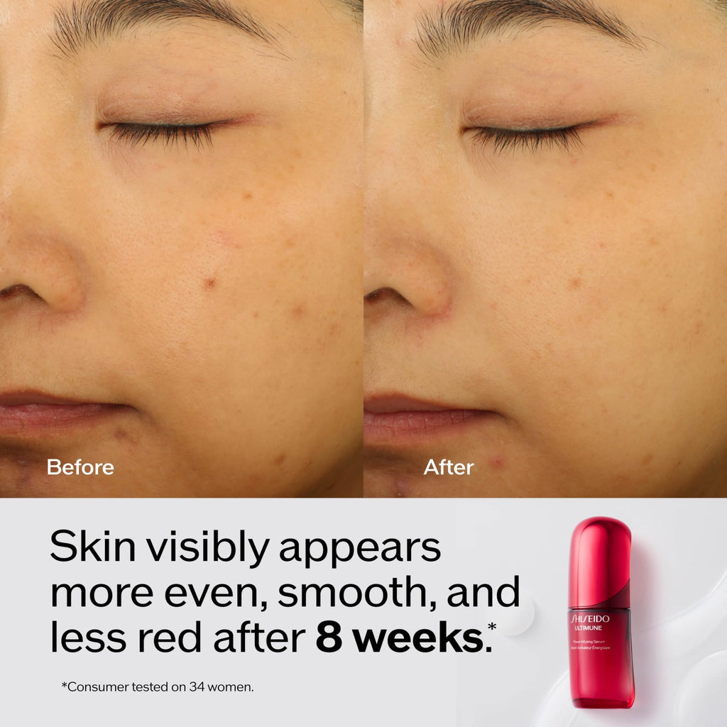 Shiseido Ultimune Power Infusing Serum Refill – 2.5 oz | Lightweight Radiance & Aging Support