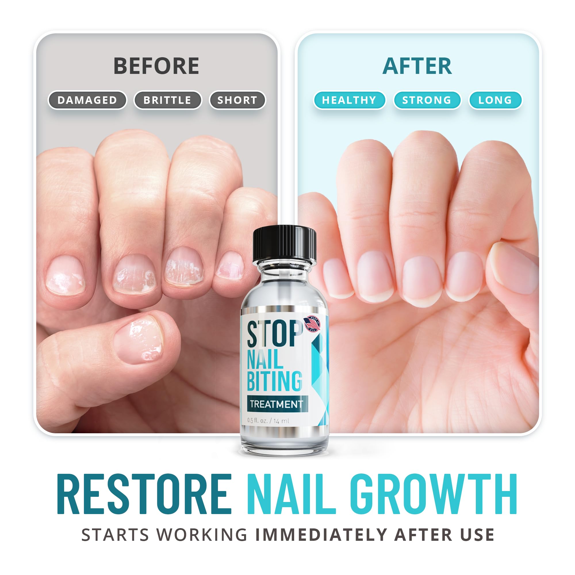 Stop Nail Biting Polish for Kids — Clear Bitter Deterrent, Easy Application (SISQUOC HEALTHCARE, 0.5 fl oz)